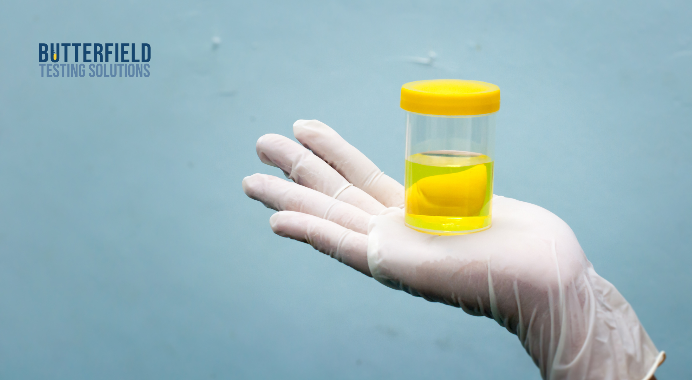 Rapid Urine Test Turnaround Times and How Onsite Collections Reduce Downtime